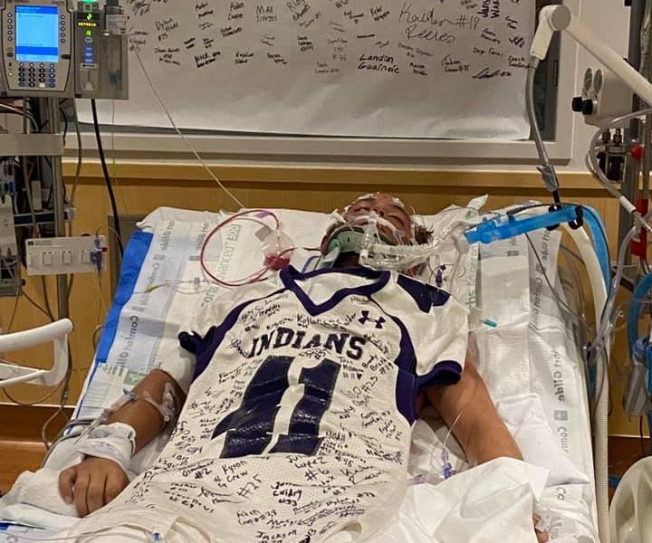 Texas High School Player Was In a Coma From InGame Hit